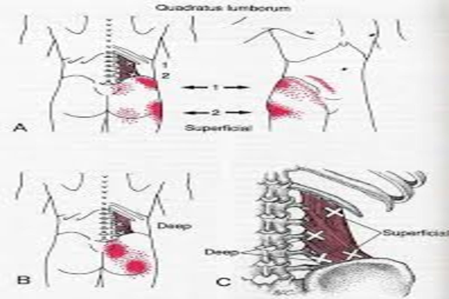 Muskeltiefenbehandlung sogenannte Trigger Punkte